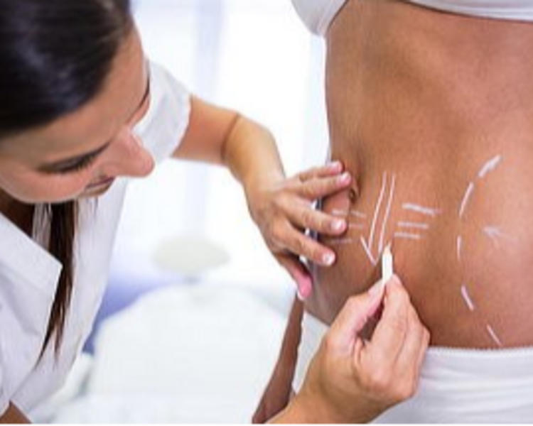 Paquete Reductor - 8 sesiones