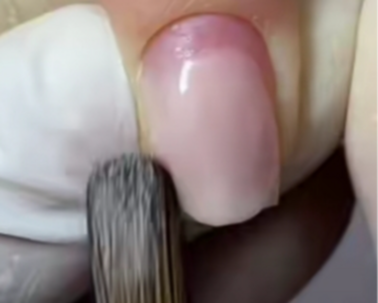 Cambio de forma en baño de acrilico