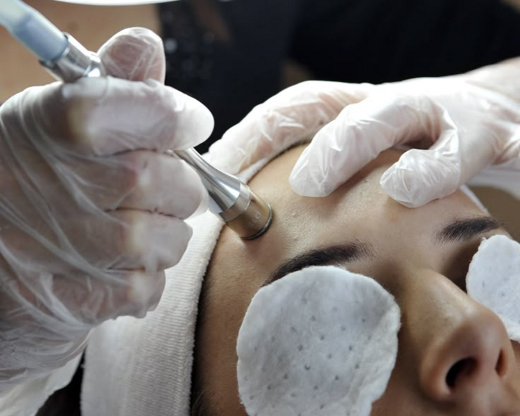 Puntas de Diamantes con Extracciones + Limpieza Facial