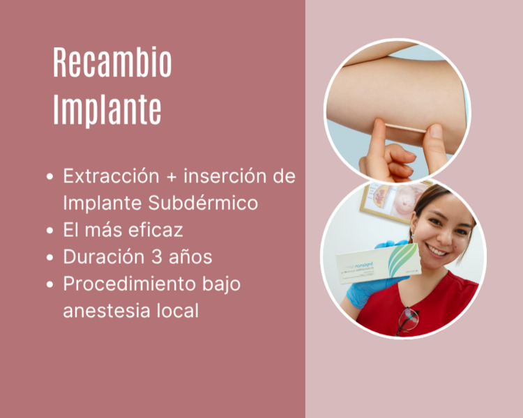 Recambio Implanon 