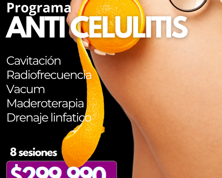 BLACK PROGRAMA ANTICELULITIS 