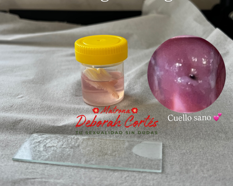 Consulta Ginecológica