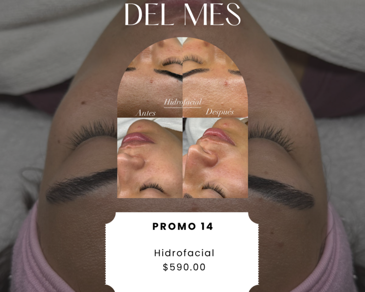 Promo Hidrofacial