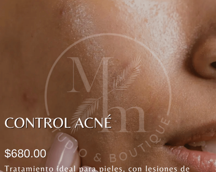Facial Control Acne