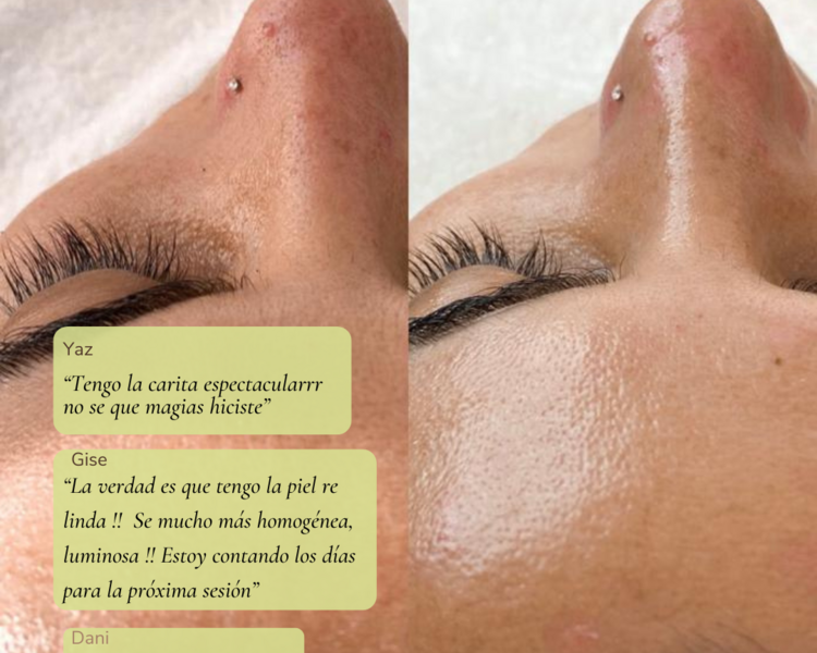 Facial: Limpieza profunda 