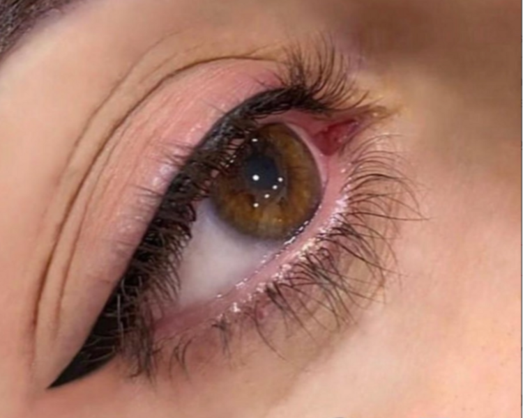 Cat Eye (retoque anual)