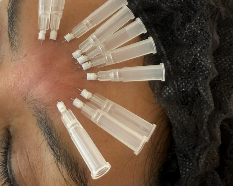 Malla de 20 hilos revitalizantes