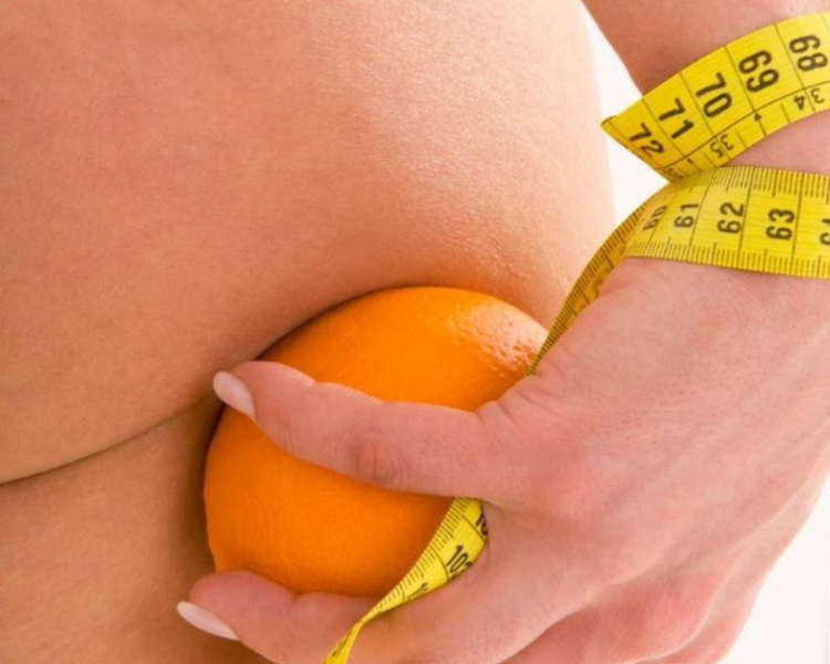 TRATAMIENTO ANTI CELULITICO 