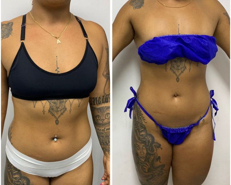 REDUCE , MOLDEA Y TONIFICA 