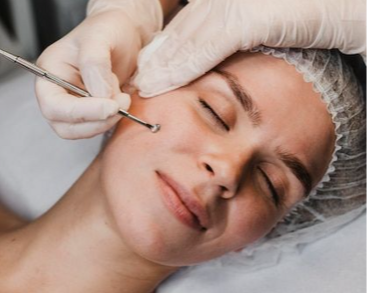 LIMPIEZA FACIAL PROFUNDA