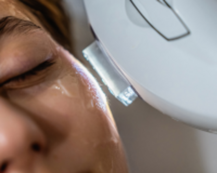  Foto Rejuvenecimiento