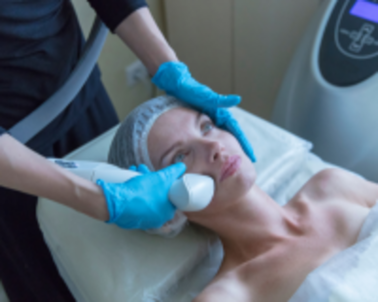 Depilación OPT Cuerpo Superior