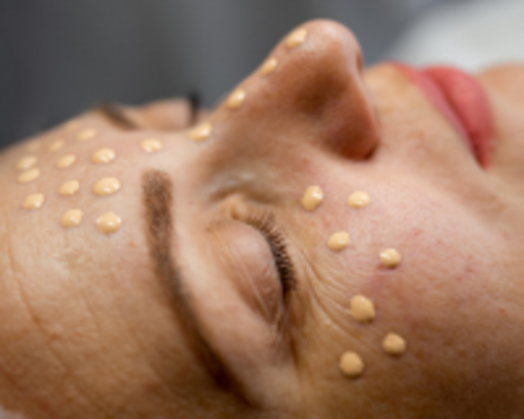 Tratamiento Nano Glow Infusión ( BB Glow)