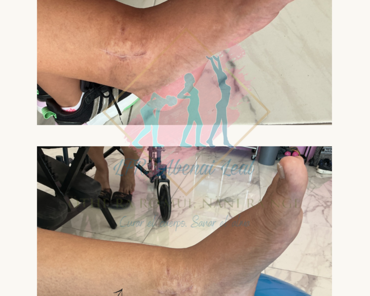 Paquete de 8 sesiones