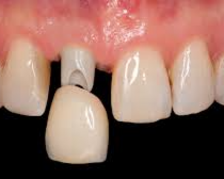 Rehabilitación /Estética Bucal