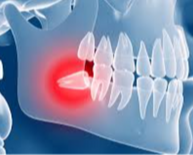 Cirugía Maxilofacial