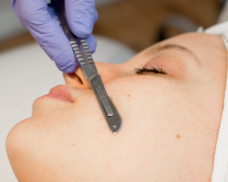 Peeling de verano + Dermaplaning + Electroporador