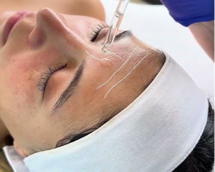 Hilos cosmetologicos