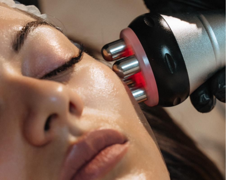 Tratamiento Radiofrecuencia