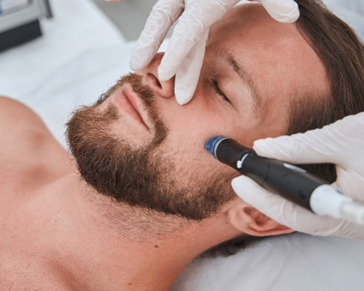Microneedling Facial