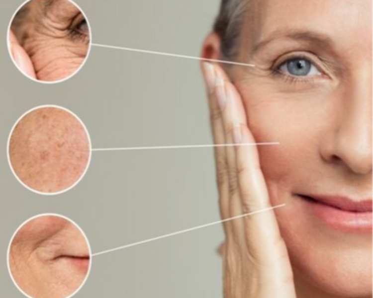 Radiofrecuencia Facial