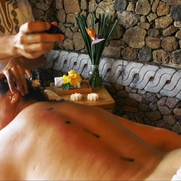 TERAPIA GOTA DE LLUVIA