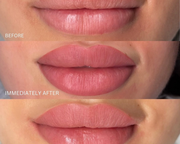 Retoque de micropigmentacion AL MES