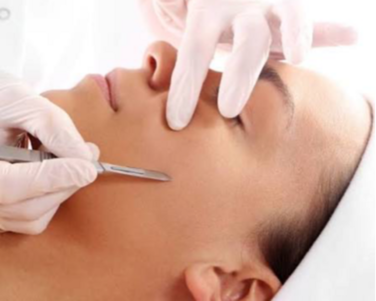 DERMAPLANING 