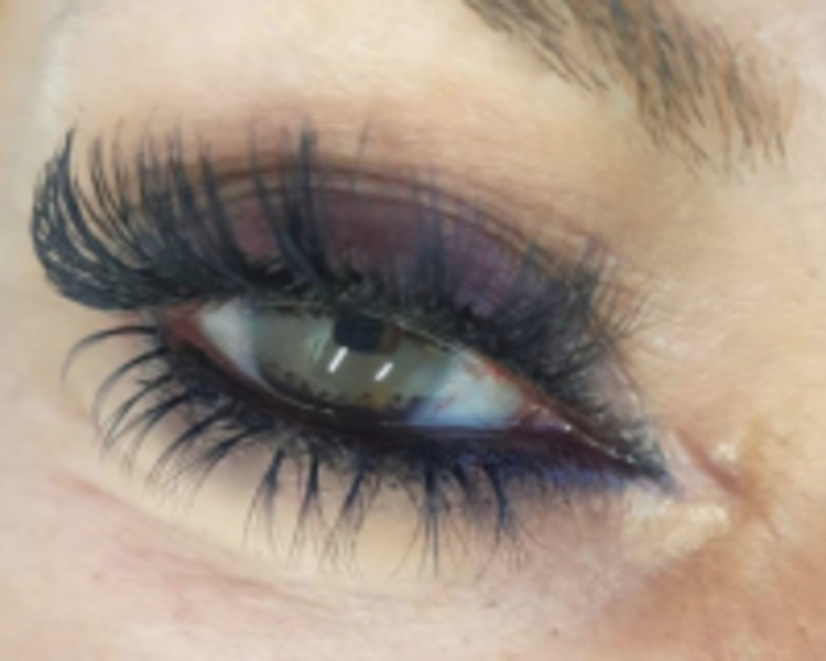 Reposición completa de pestañas, INFERIORES