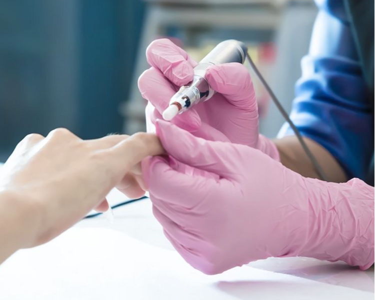 Remoción Extensiones