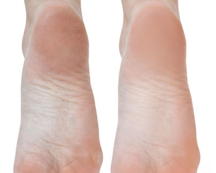 Pedicura Spa SOLO LIMPIEZA