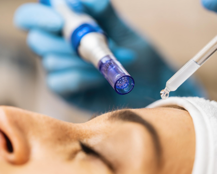 DERMAPEN CICATRICES ACNE TIMOX