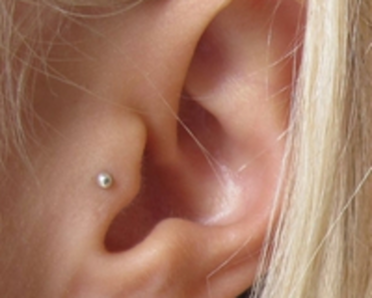 TRAGUS