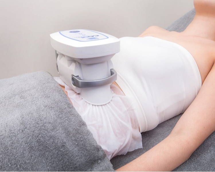 Sesión de Criolipolisis 4D