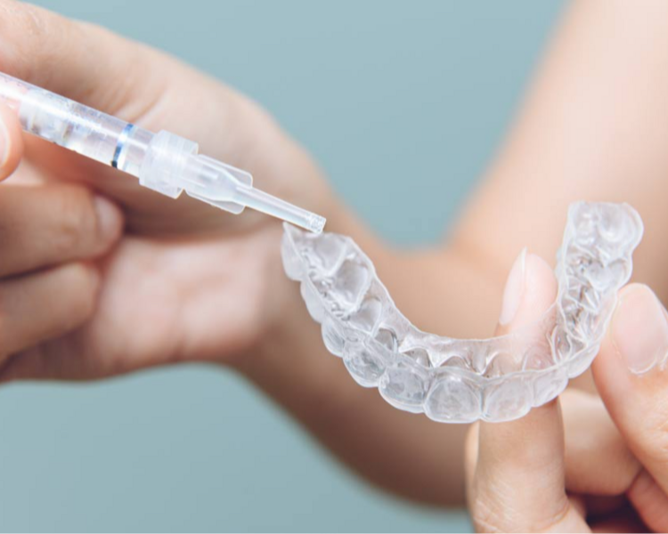 Blanqueamiento + cubetas para blanqueamiento en casa (requiere ev. + limpieza)