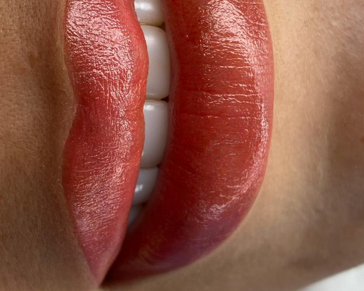 Retoque Labios (1 mes)