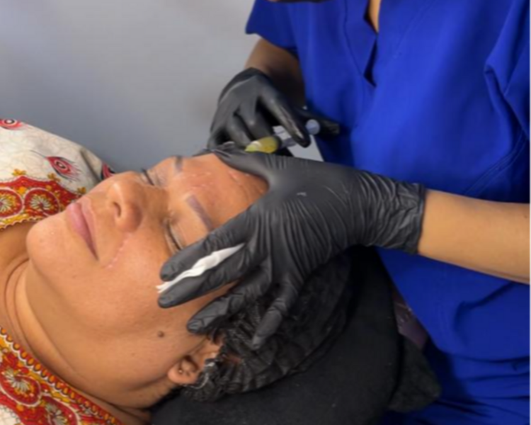 Plasma Facial