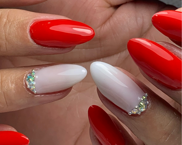 Kapping con limado o nivelación (FERNANDA JARA)  