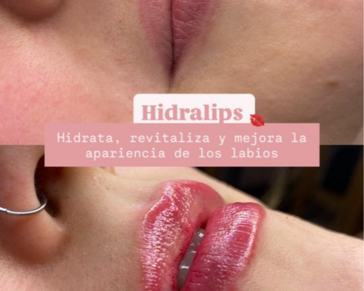 Hidralips