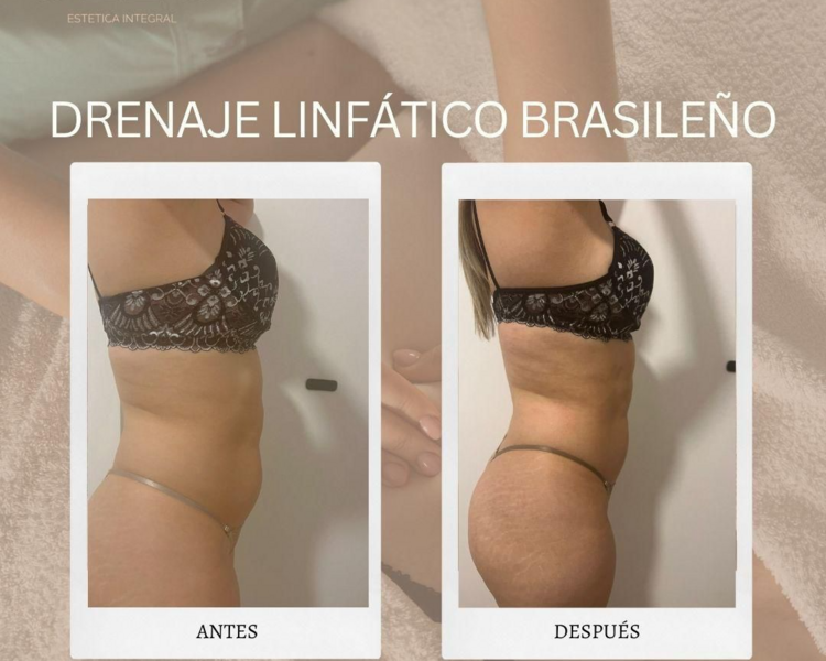 🇧🇷 DRENAJE LINFATICO BRASILEÑO + MADEROTERAPIA  (ABDOMEN)