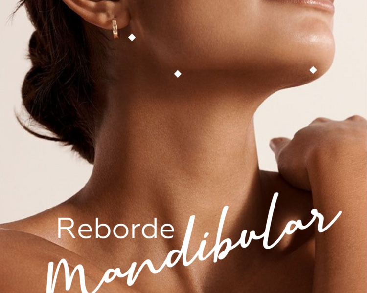 Relleno de Reborde Mandibular con Ácido Hialurónico