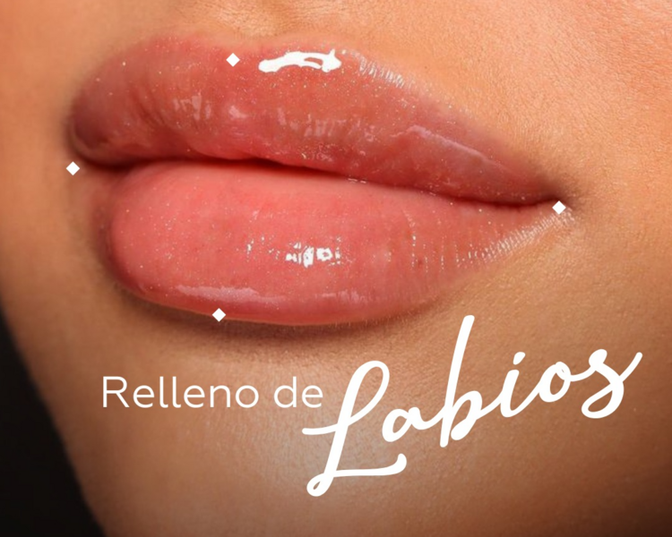 Relleno de Labios 