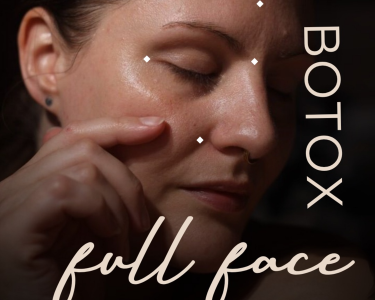 Botox Full Face ( Tercio superior e inferior completo )