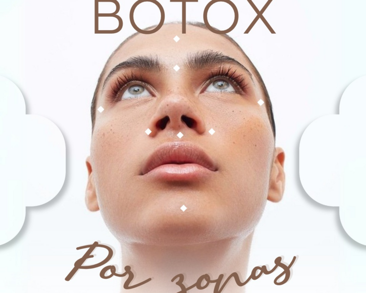 Botox 1 Zona ( Frontal , entrecejo y patas de gallo )