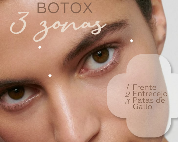 Botox Tercio Superior ( Frontal, entrecejo y patas de gallo )