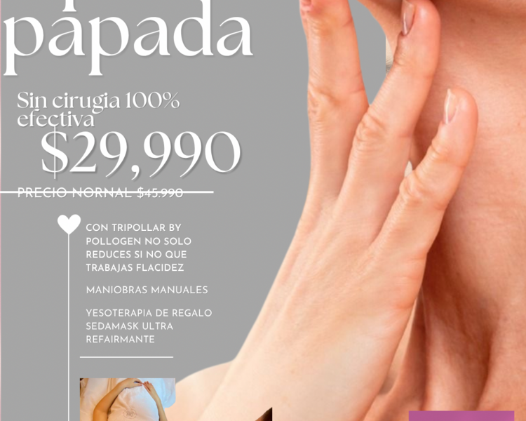 Lipopapada con tripollar + tecnicas