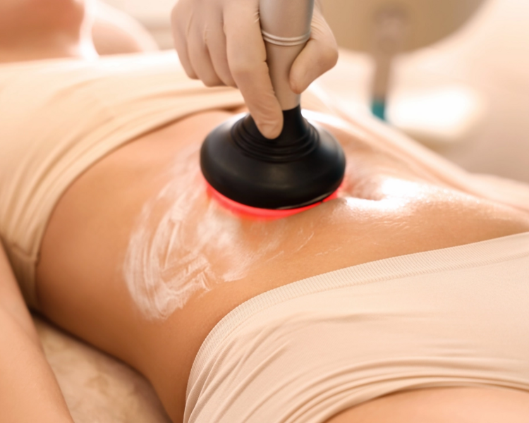 Radiofrecuencia corporal