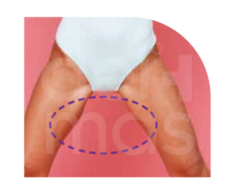 Depilación Entrepiernas