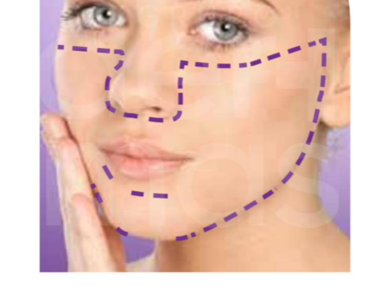 Depilación Media Cara