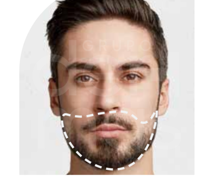 Depilación Barba Completa